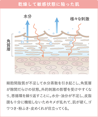 乾燥して敏感状態に陥った肌 細胞間脂質が不足して水分蒸散を引き起こし、角質層が隙間だらけの状態。外的刺激の影響を受けやすくなり、悪循環を繰り返すことに。水分・油分が不足し、皮脂膜も十分に機能しないためキメが乱れて、肌が硬く、ゴワつき・粉ふき・皮めくれが目立ってくる。