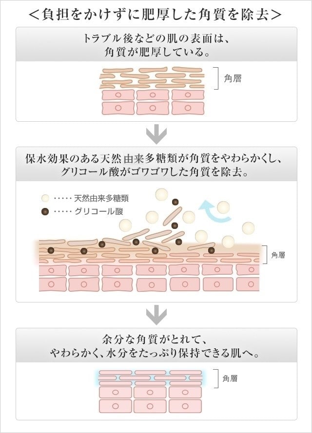 負担をかけずに肥厚した角質を除去