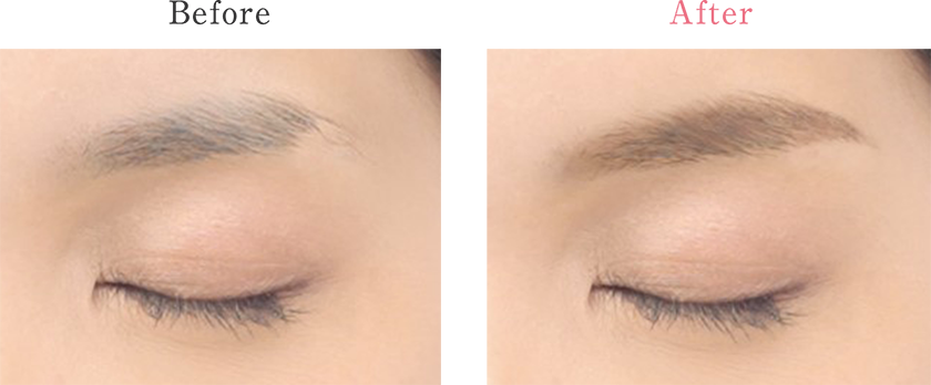 before after